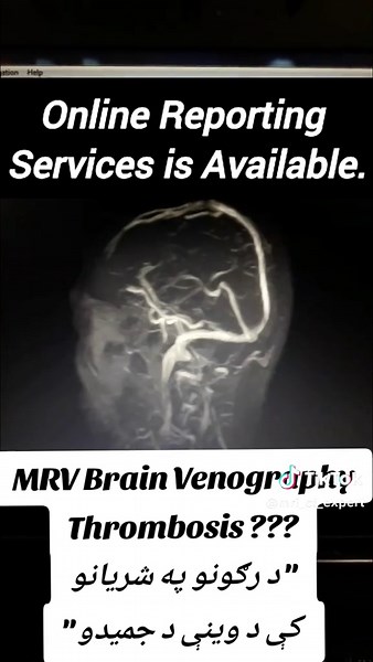 MRI & CT_Expert on TikTok
