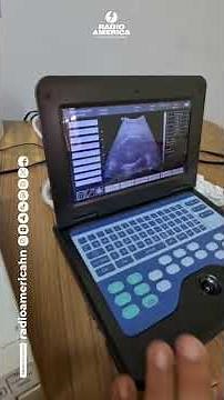 ULTRASOUND
