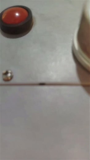 ScanAndLearn on Instagram: "🩻🦴X-ray scaphoid view" refers to a specific series of radiographic projections designed to best visualize the scaphoid bone in the wrist, as it is a common site for fracture (especially after a fall onto an outstretched hand) and fractures can be difficult to see on standard wrist X-rays. While the exact number and combination of views can vary slightly between institutions, a dedicated Scaphoid Series typically includes: Posteroanterior (PA) View in Ulnar Deviation