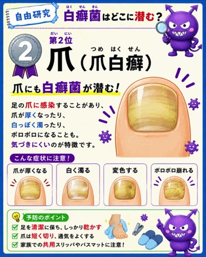【フットケアに特化した製薬会社】白癬菌はどこに潜む？？ #自由研究 #豆知識 #健康 #水虫 #爪水虫 #白癬菌 #フットケア #雑学 #夏休み #ライフハック #shorts
