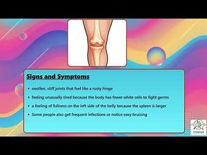 Felty's Syndrome Explained Causes, Symptoms and Treatment, All Insights