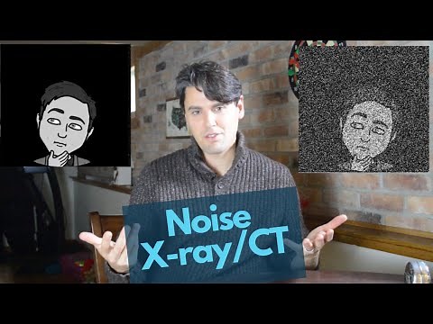 X-ray Image Noise (Image Noise and Dose | Rad Techs)