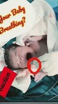 Newborn Airway Suction 👶#mbbslife #NewbornCare #Suction #AirwayClearing #NursingSkills #vairalvideo