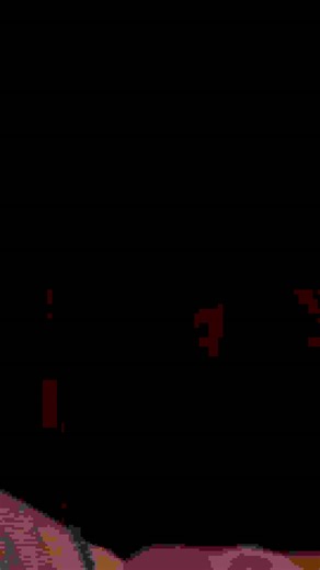 Girl is ashamed of her stretch marks