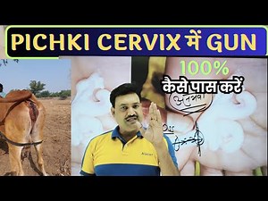 How to prepare shrunken cervix for gun pass 😇 cervix me gun kaise pass kare