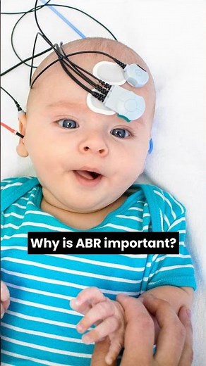 ABR Testing: Your Hearing's Silent Guardian
