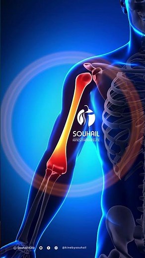 ⚠️ Humerus fracture: how to treat it and recover faster?