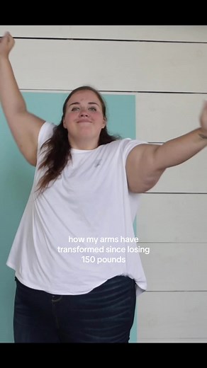 Loose Skin Surgery & Weight Loss: My Arm Transformation