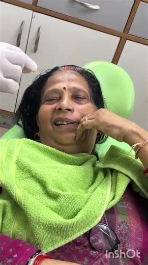 Ultra - smooth extraction of an RCT treated tooth