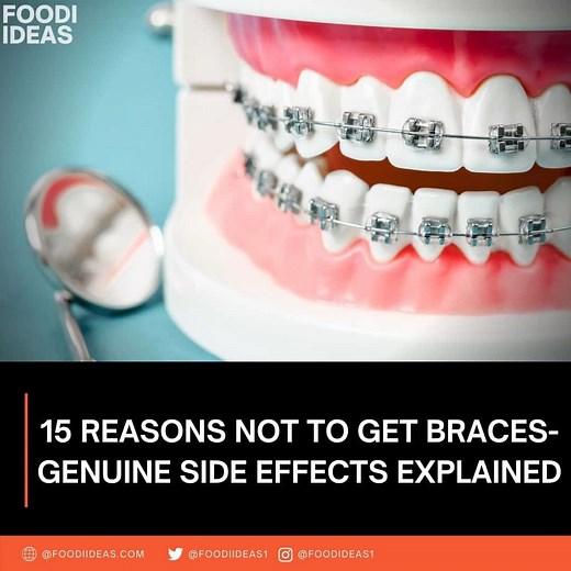 15 Reasons Not To Get Braces - Top Side Effects Explained