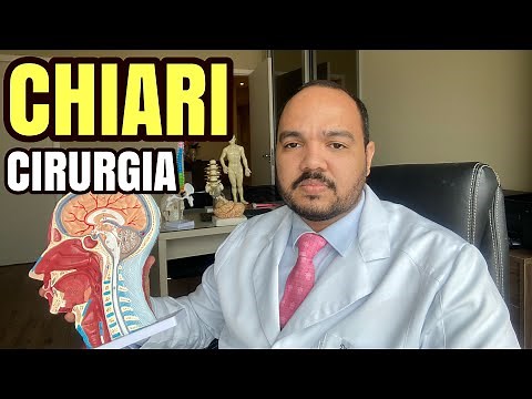 Como é feita a cirurgia de Chiari? Malformação de Arnold-Chiari tipo 1