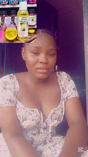 Strong Peeling Oil Review for Stretch Mark Removal