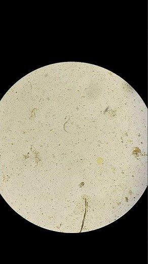 Hookworm under the microscope #shorts