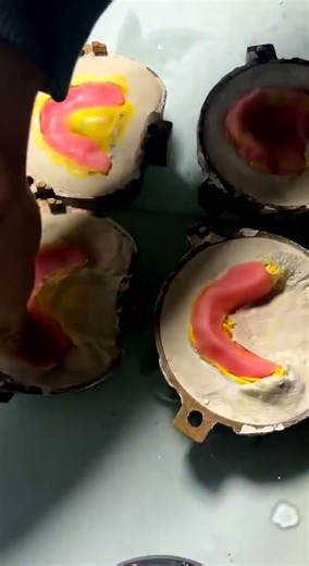 The whole process of making a set of teeth