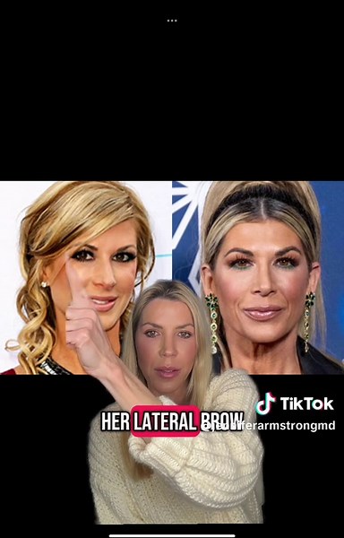 Alexis Bellino: Transformations Examined in Detail