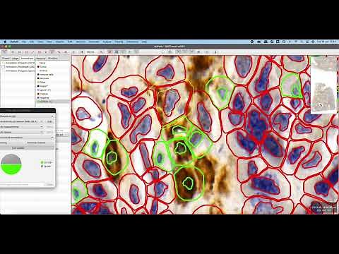 Training an Object Classifier in Qupath