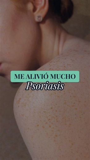 PSORIASIS: 3 Things I Do to Relieve the Itch
