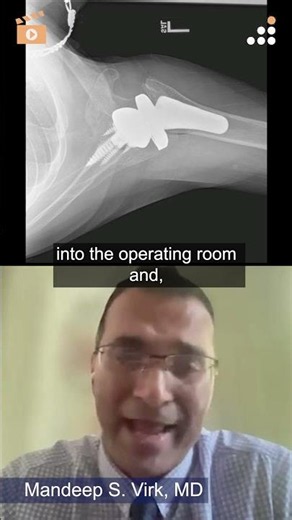 Computer Nav in Total Shoulder Arthroplasty