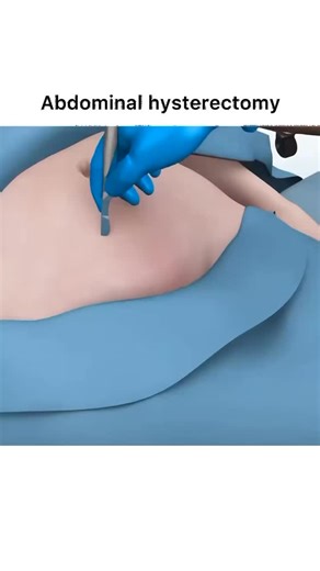 Animations | Follow @surgicalanimation for more!🏥 | Instagram