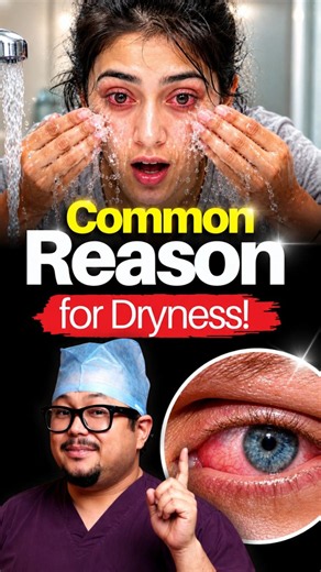 This is Increasing Your Problem of Dry Eyes ‼️