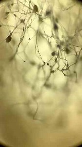 What Mold Spores Really Look Like Under the Microscope