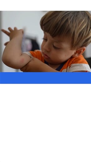 Itchy bug bites and upset stomachs can turn a fun summer into a big bummer. Don't let minor injury or illness put a stop to your plans. Get fast, affordable, expert care with SSM Health Express Virtual Care, available from 6 am - 10 pm every day. ssmhealth.com/visitnow | SSM Health