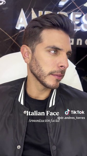 Italian Face: Armonización Facial para Hombres