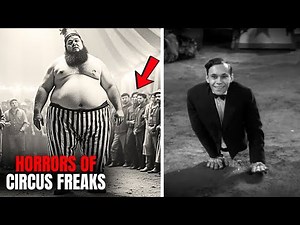 15 Bizarre Circus Freaks You Won’t Believe Are Real