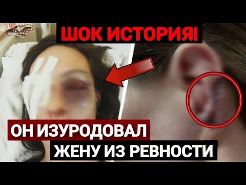 ЖЕСТЬ ИЗ КРАСНОДАРА | МУЖ ВЫДАВИЛ ГЛАЗА ЖЕНЕ ЧТОБЫ ОНА НЕ ЗАГУЛЯЛА