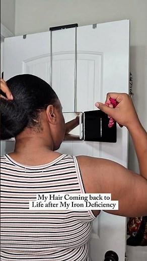 My Hair Is Coming Back to Life After Iron Deficiency | Hair Growth Journey