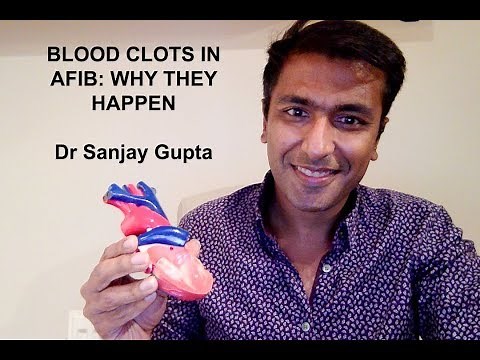 Blood clots in Afib - why they happen