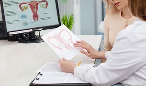 Wat is een verzakking of prolaps en hoe wordt het behandeld? | gezondheid.be