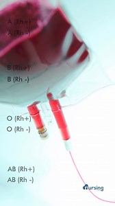 📝 Blood Compatibility Basics Don’t let your knowledge ‘run low’—download our 77 Must-Know Nursing Topics for free and boost your study game! Click the link in our bio or visit nursing.com/nfn to get started! 🩸📚✨ 🔴 Type O-: Universal donor—can donate to all blood types. 🟢 Type AB : Universal recipient—can receive blood from all blood types. 🔵 Type A: Can receive from Type A and Type O. 🟡 Type B: Can receive from Type B and Type O. 🟠 Rh Factor: Patients with Rh blood can receive both Rh an