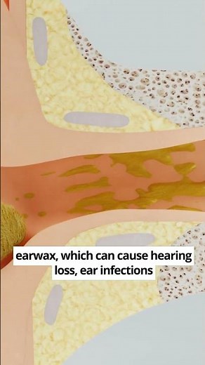 Why Using Q-Tips Feels So Good 🥴 (NOT good) #shorts