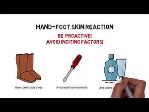 HCC Whiteboard #3: The Management of Adverse Events of Tyrosine Kinase Inhibitors