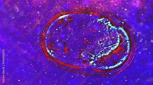 Cancer cells illustration spreading in a body