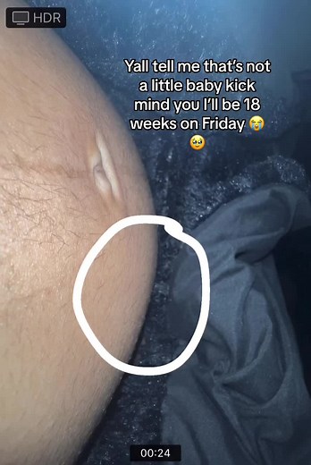 Baby Kick at 18 Weeks Pregnant - Amazing Video of Baby Movement