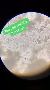 What’s Really Inside Your Yogurt Under the Microscope