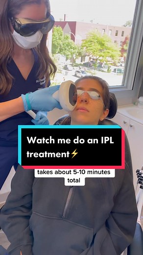 IPL (intense pulse light) is an incredible in office treatment to help alleviate dry eye!! It can also be uses to treat styes 🤩 Have you had it yet? Would love to know your experience 👇🏻 #styetok #dryeyedisease #eyedropshop #howtotreatdryeye #dryeyetips #eyehealthtips