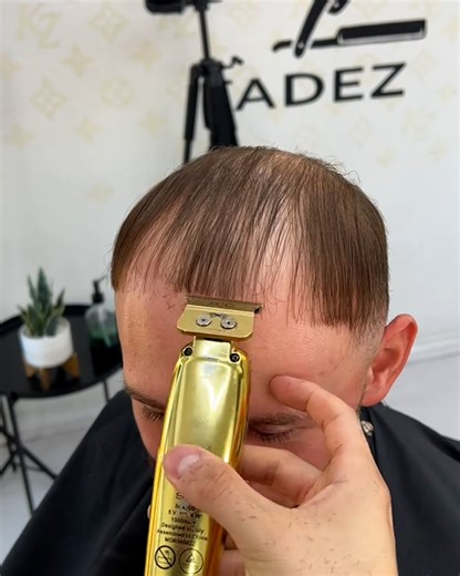 1.9M views · 7K reactions | Saving hairlines without transplants  | UNILAD | Facebook