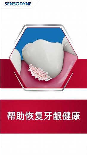 Sensodyne Sensitivity Gum & Enamel Mand 9:16 15s