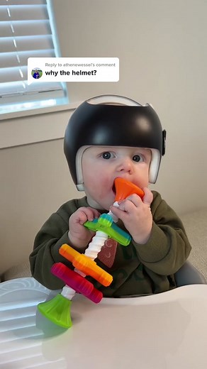 Understanding why Babies Wear Helmets: A Closer Look at Plagiocephaly