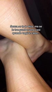 Quando si passa tanto tempo seduti o in piedi, le gambe tendono a trattenere liquidi, risultando pesanti e lasciando il segno delle calze sulle caviglie. Questo a lungo andare può peggiorare la circolazione e aumentare il rischio di vene varicose. Se anche tu hai il segno delle calze sulla caviglia, prima di dormire prova questa routine. Puoi farla semplicemente dal tuo letto, prima con una gamba e poi con la gamba opposta. Nel breve periodo le tue gambe saranno più leggere e sgonfie e nel lungo