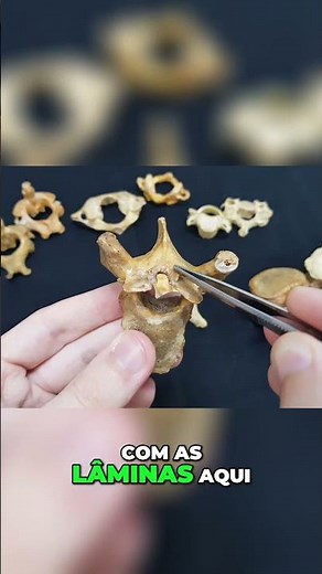 Anatomy of the Vertebrae: Vertebral Bodies, Arches and Processes - Free Human Anatomy Class