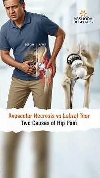 Avascular Necrosis vs Labral Tear: Two Causes of Hip Pain | Dr. Prabhat Reddy Lakkireddi