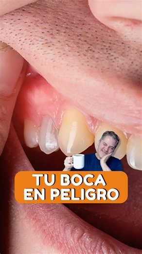 Why does my tooth hurt when I eat or drink hot or cold food? - Specialist Doctors