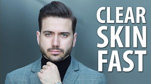 How to get clear skin fast men's skincare routine