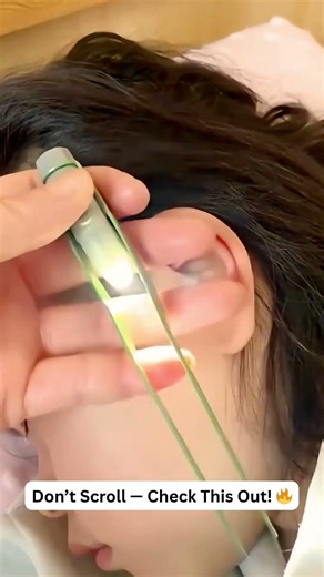 🔥Smart Ear Cleaner with Light 👂✨ | Safe & Pain-Free Ear Wax Removal #3634 ‪@sovorsgadget‬