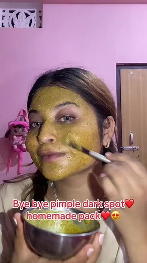 Pimple Dark Spot Removal: Homemade Remedies in Nepal