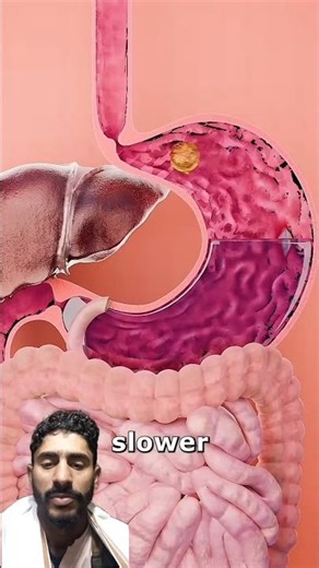 💥Why You Gain Weight Faster Than Others!!🤔#3d #facts #health #science #shortsfeed #fitness